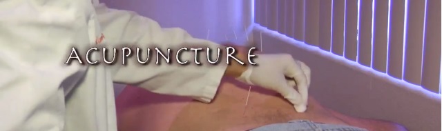 Acupuncture